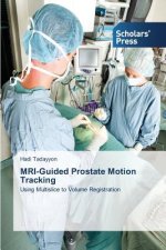 MRI-Guided Prostate Motion Tracking