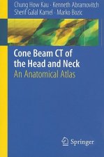 Cone Beam CT of the Head and Neck