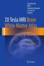 7.0 Tesla MRI Brain White Matter Atlas