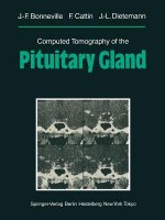 Computed Tomography of the Pituitary Gland