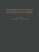 Technique of Internal Fixation of Fractures