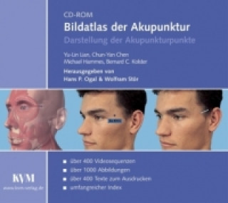 Bildatlas der Akupunktur, 1 CD-ROM