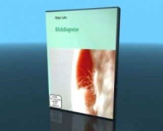 Blickdiagnose, 2 DVDs