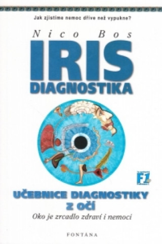 IRIS Diagnostika