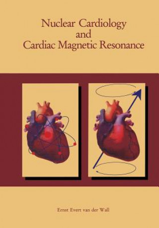 Nuclear Cardiology and Cardiac Magnetic Resonance