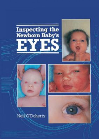 Inspecting the Newborn Baby's Eyes