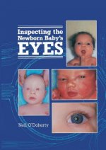 Inspecting the Newborn Baby's Eyes
