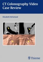Clinical Case Review of CT Colonography, CD-ROM