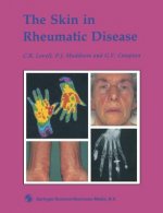 Skin in Rheumatic Disease