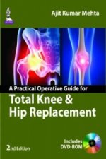 Practical Operative Guide for Total Knee and Hip Replacement