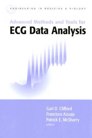 Advanced Methods and Tools for ECG Data Analysis
