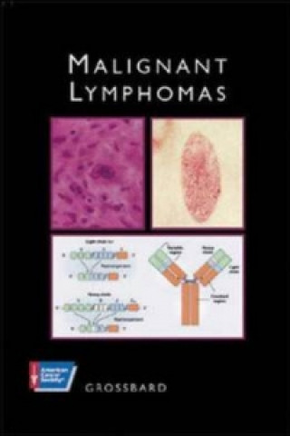 MALIGNANT LYMPHOMAS