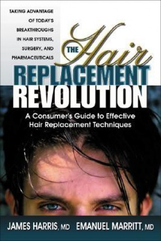 Hair Replacement Revolution