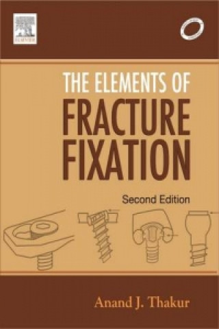 Elements of Fracture Fixation