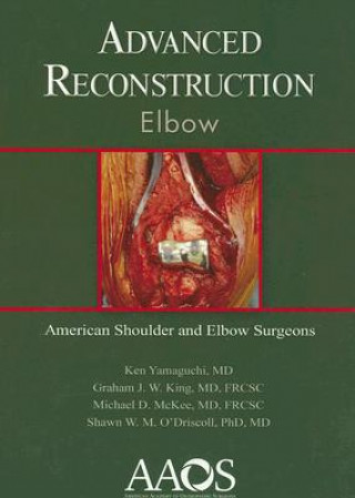 Advanced Reconstruction: Elbow