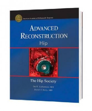 Advanced Reconstruction