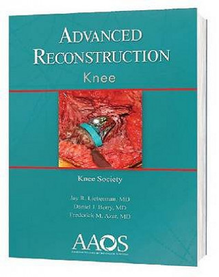 Advanced Reconstruction: Knee