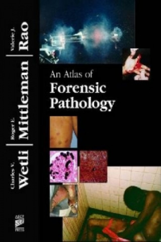 Atlas of Forensic Pathology