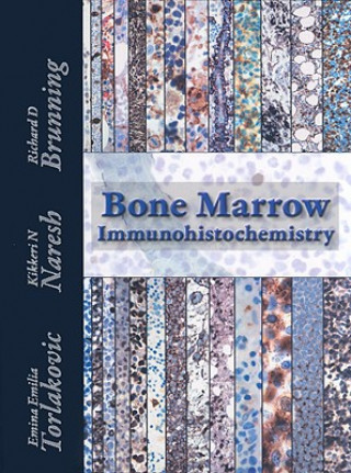 Bone Marrow Immunohistochemistry