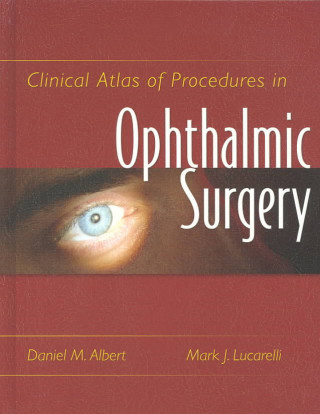 Clinical Atlas of Procedures in Ophthalmic Surgery