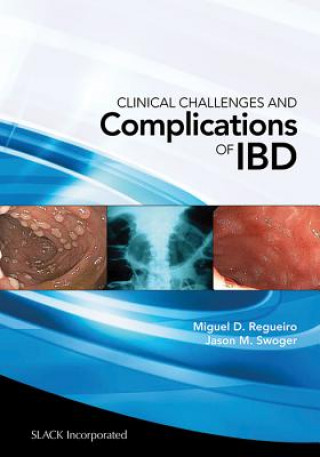 Clinical Challenges and Complications of IBD