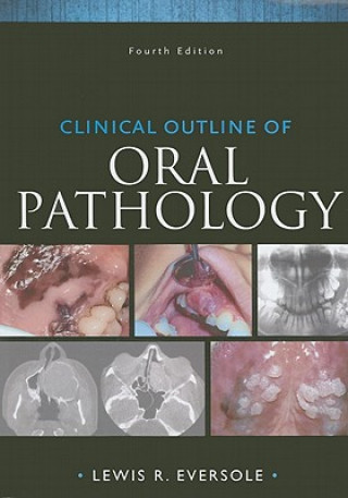 Clinical Outline of Oral Pathology