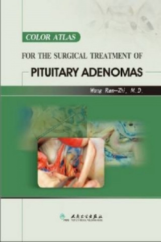 Color Atlas for the Surgical Treatment of Pituitary Adenomas
