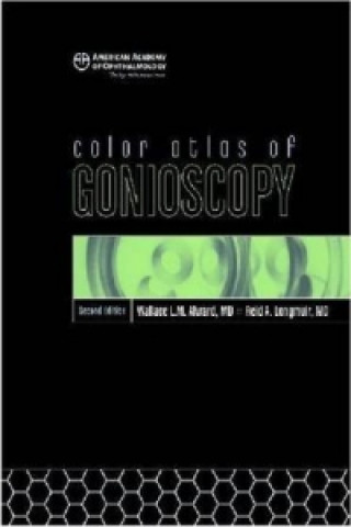 Color Atlas of Gonioscopy