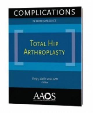 Complications in Orthopaedics