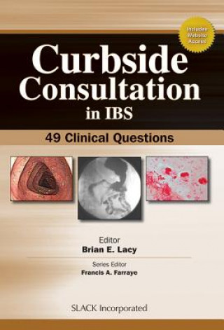 Curbside Consultations in IBS