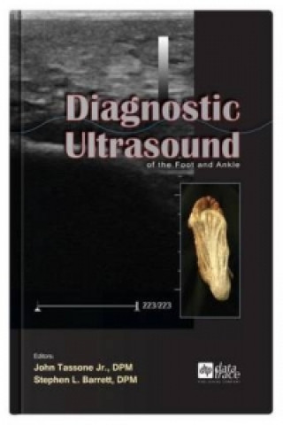 Diagnostic Ultrasound of the Foot and Ankle