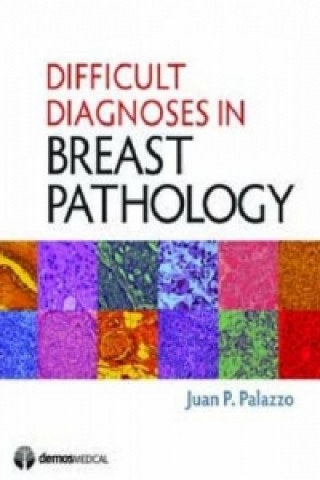 Difficult Diagnoses in Breast Pathology