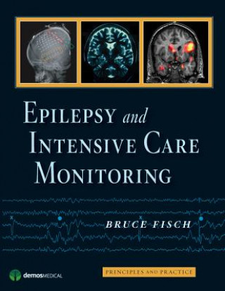 Epilepsy and Intensive Care Monitoring