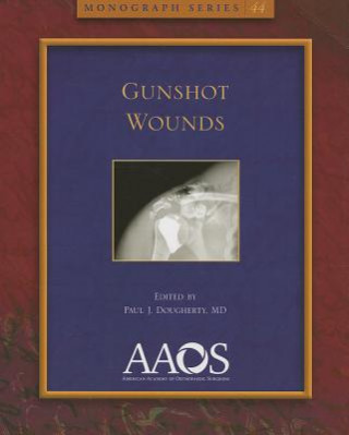 Gunshot Wounds