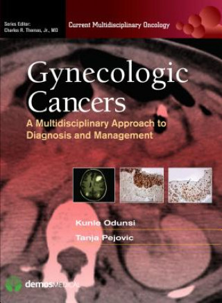Gynecologic Cancers