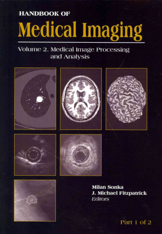 HANDBOOK OF MEDICAL IMAGING VOLUME 2. M