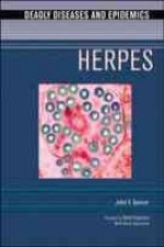 Herpes