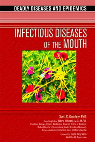 Infectious Diseases of the Mouth