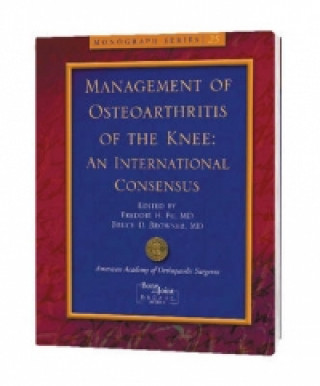Management of Knee Osteoarthritis