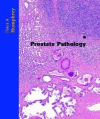 Prostate Pathology