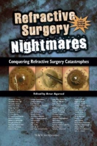 Refractive Surgery Nightmares