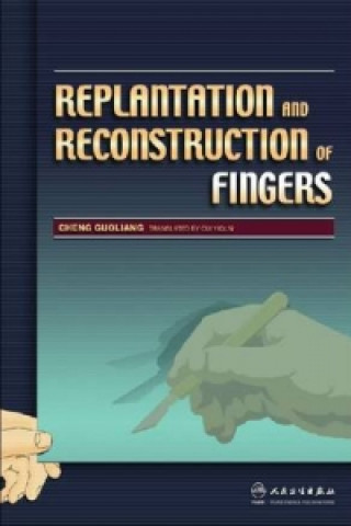 Replantation and Reconstruction of Fingers