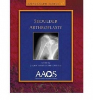 Shoulder Arthroplasty