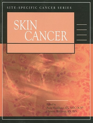 Skin Cancer