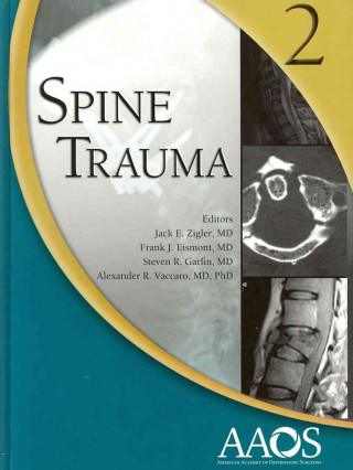 Spine Trauma