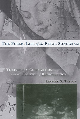 Public Life of the Fetal Sonogram