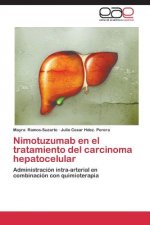 Nimotuzumab en el tratamiento del carcinoma hepatocelular