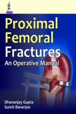 Operative Manual of Proximal Femoral Fractures