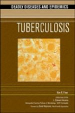 Tuberculosis