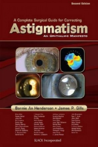 Complete Surgical Guide for Correcting Astigmatism